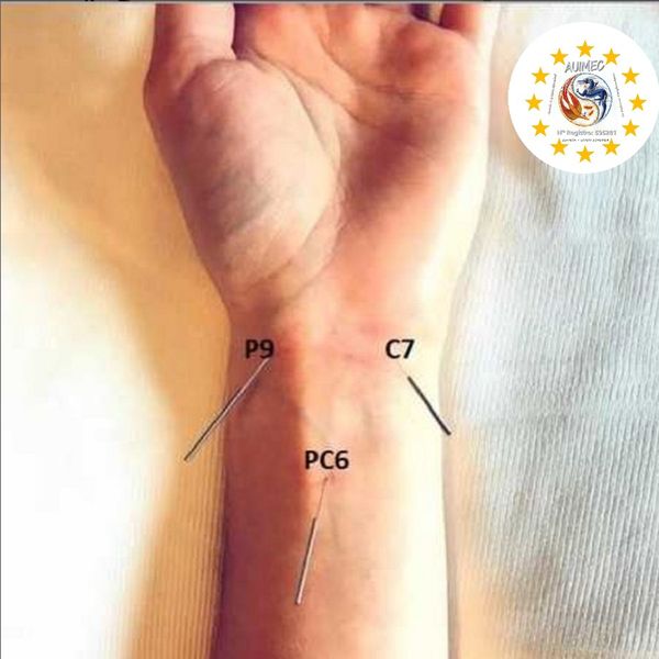 Acupuncture Pen
