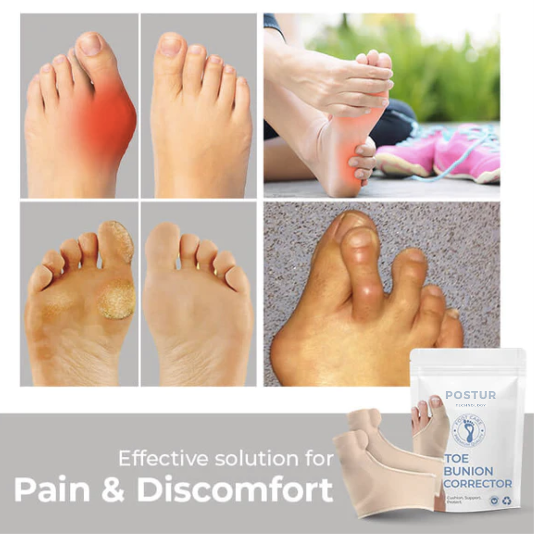 Postur | Orthopedic Bunion Corrector