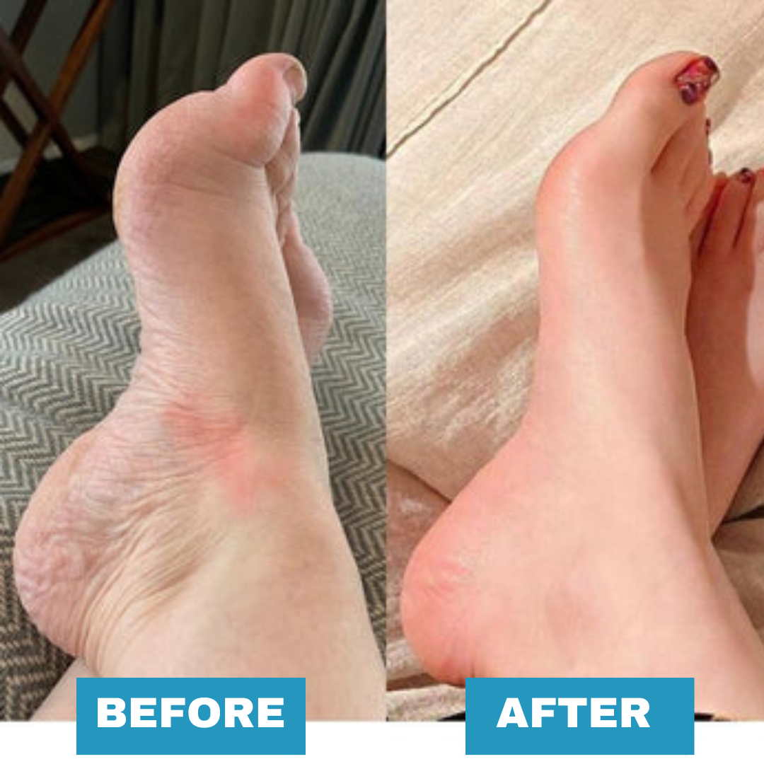 Postur | Foot Massager