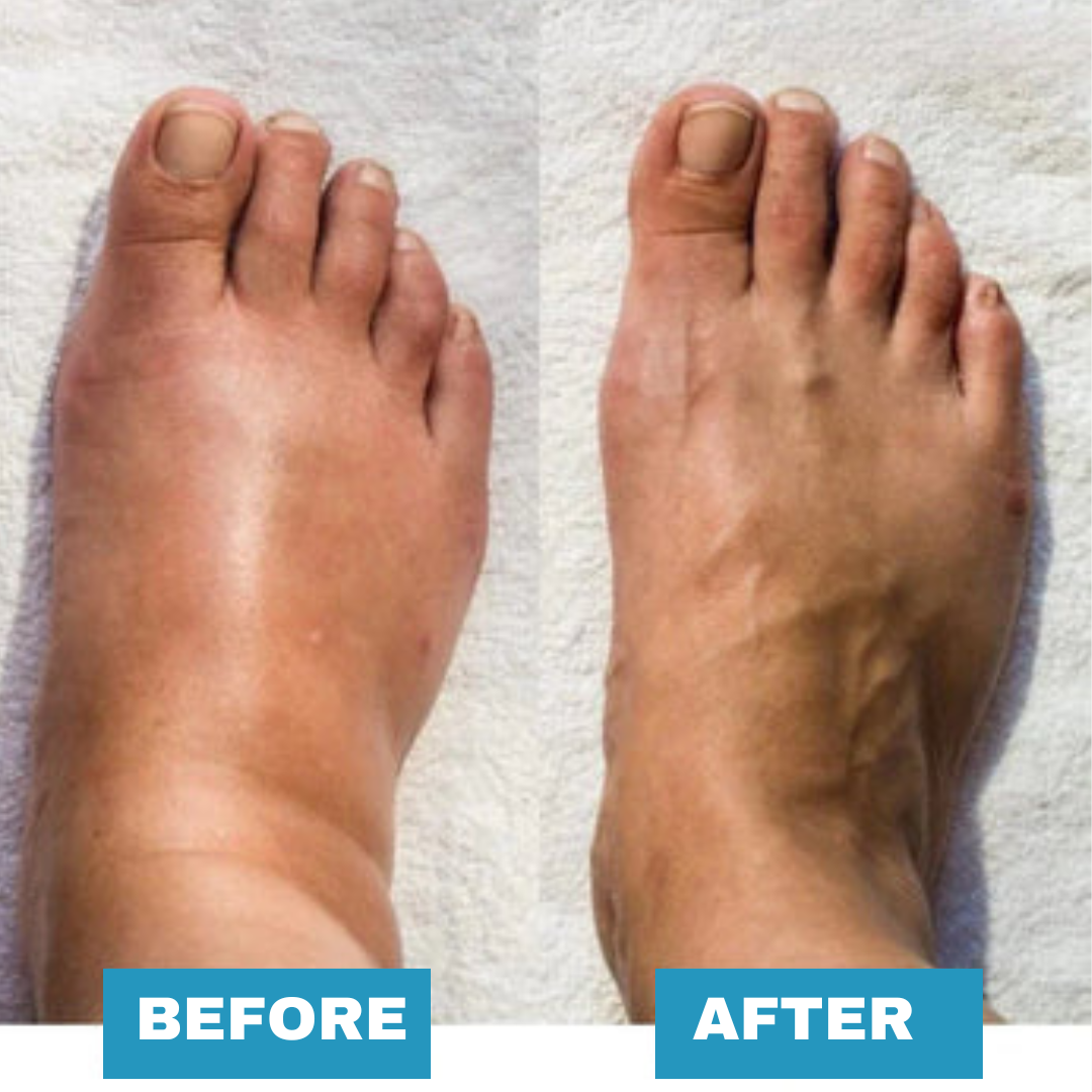 Postur | Foot Massager