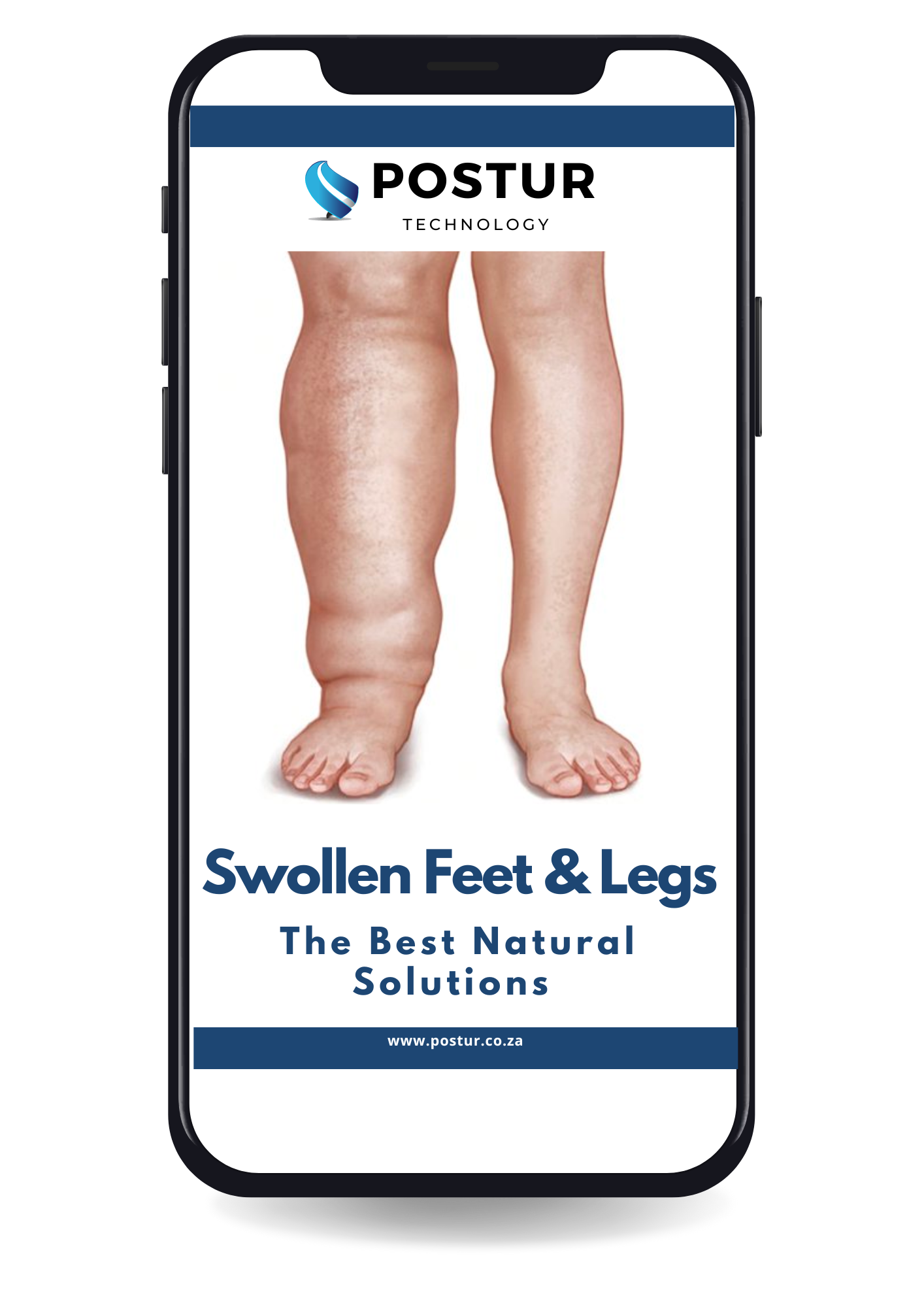 EBOOK I Swollen Feet & Legs - The Best Natural Solutions