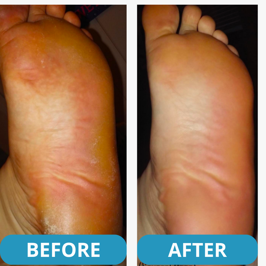 Orthopedic Air Sneakers - Experience Lasting Foot Pain Relief