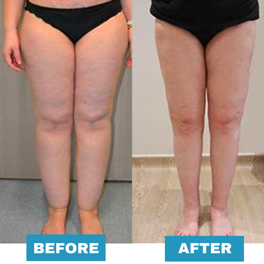 The Ultimate Whole Body Massager