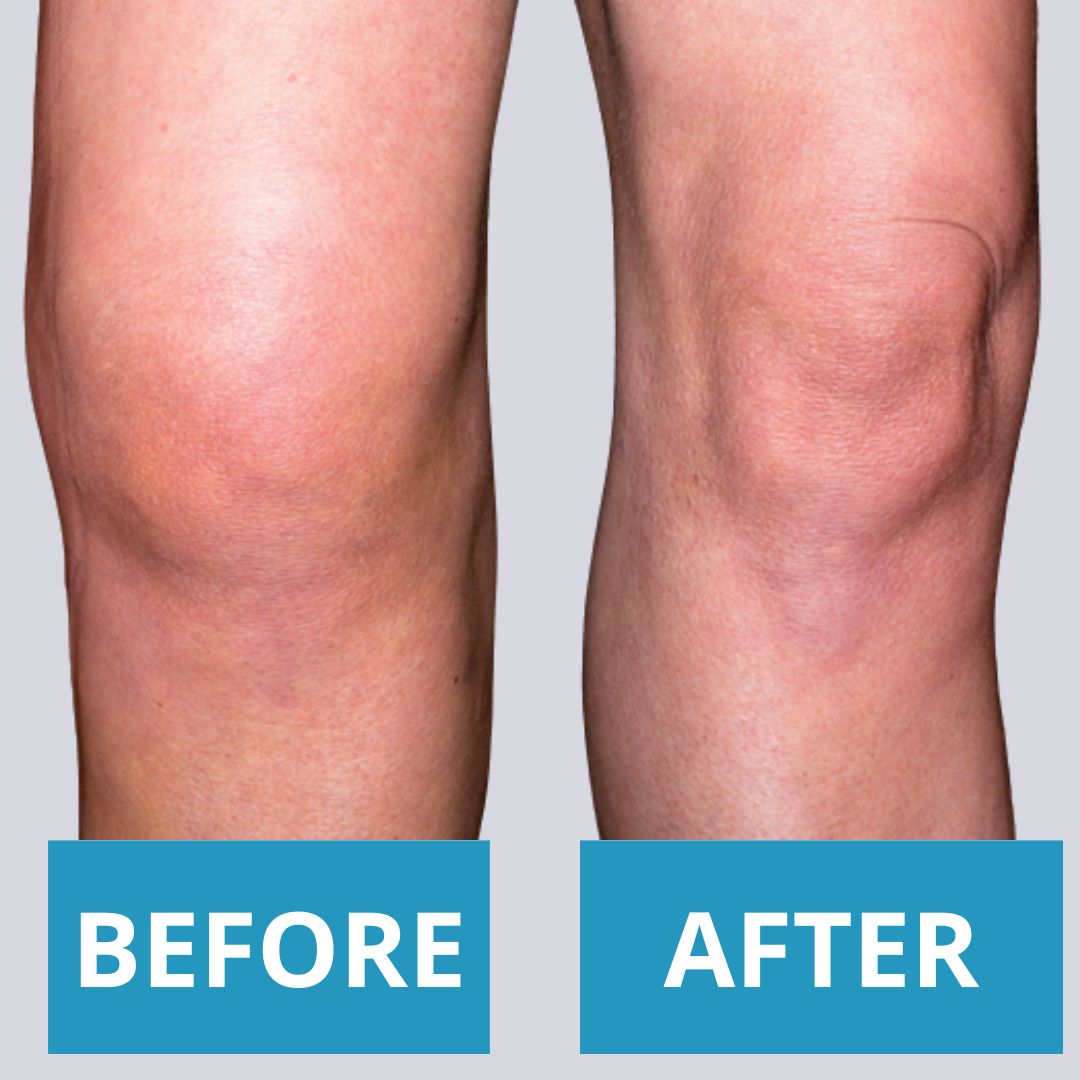 Anti-Knee pain patch